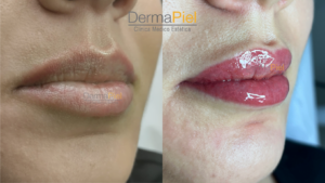 Micropigmentación de labios