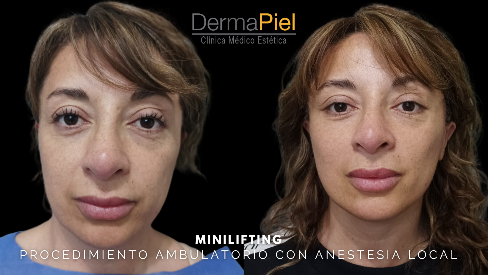 MEDICINA-ESTETICA-25.png