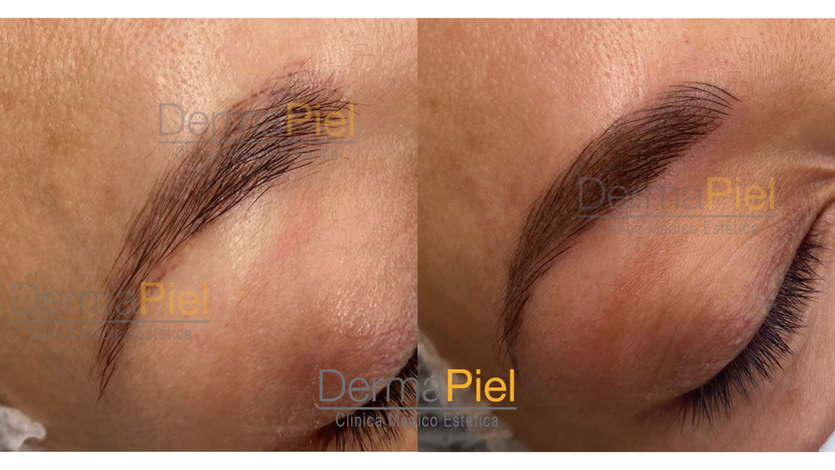 microblading-antes-y-despues.png